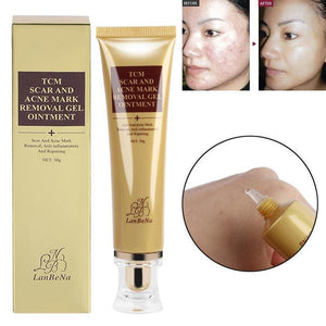 Acne Scar Remover Cream