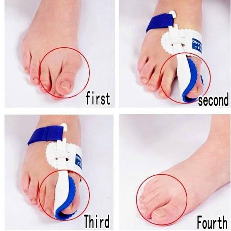 Bunion Corrector ( 1 Pair )